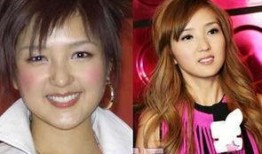 爆料娱乐圈明星整容,揭秘明星变脸真相